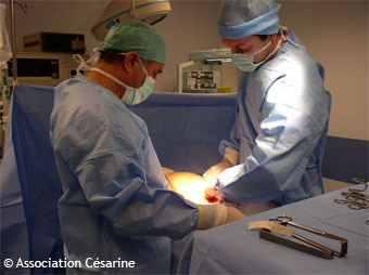 Césarienne - 1 : incision (c) 
Césarine